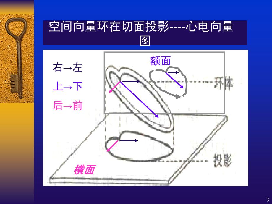 常见心电图诊断要点PPT参考课件.ppt_第3页