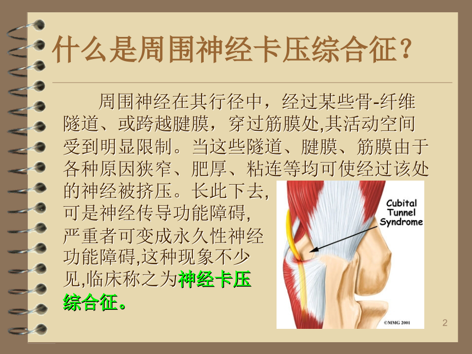 周围神经卡压.ppt_第2页