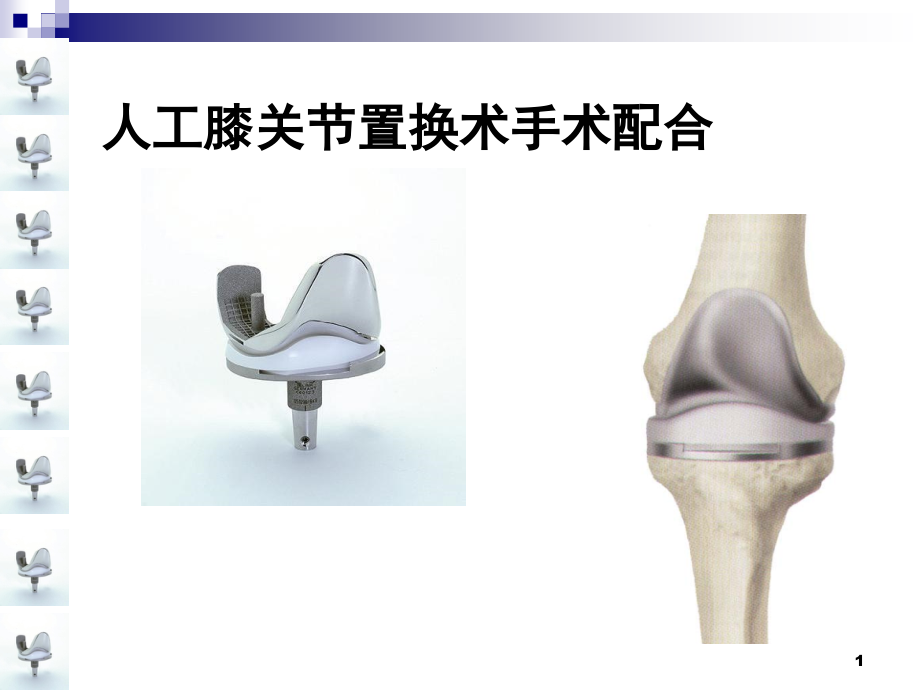 人工膝关节置换术手术配合ppt课件.ppt_第1页