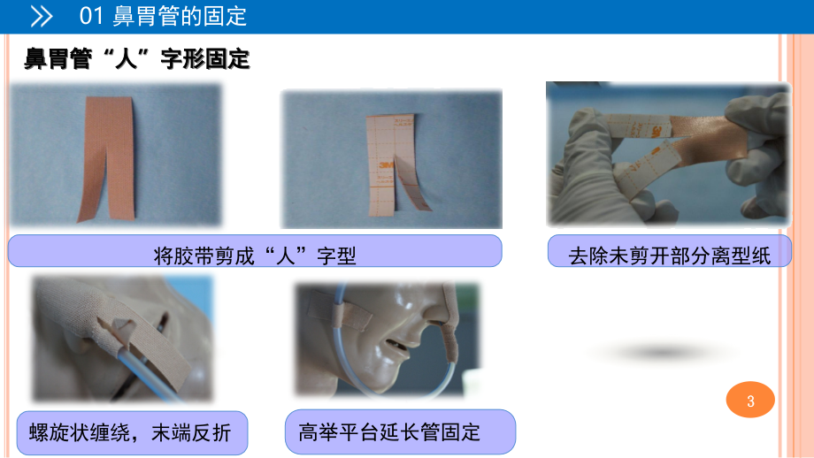 各种常见留置管道的固定方法(课堂PPT).ppt_第3页