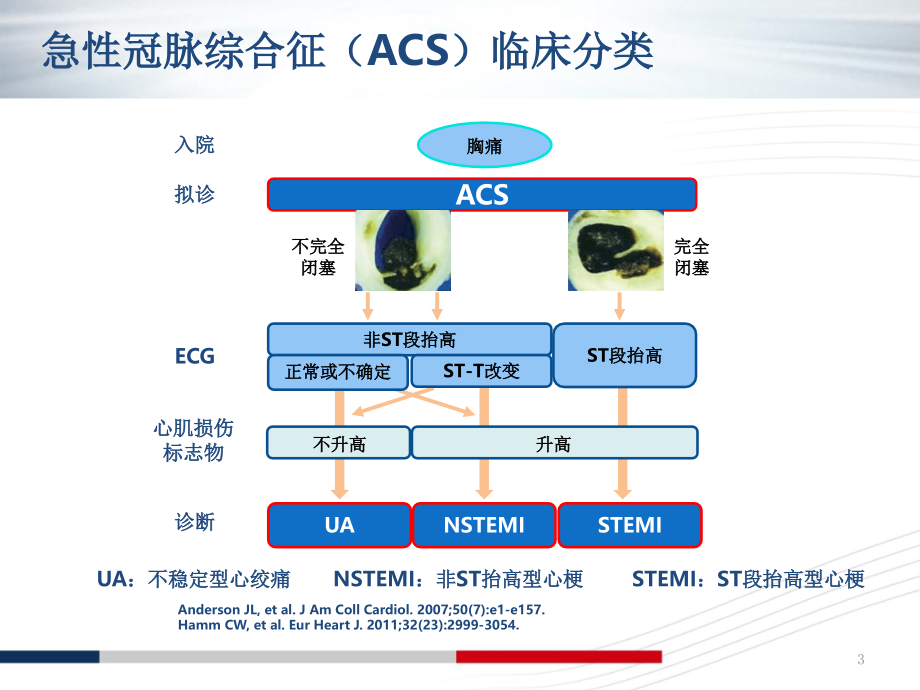 NSTE-ACS诊断标准和治疗原则解读课件.ppt_第3页