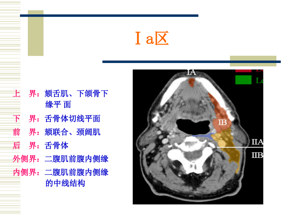 鼻咽癌淋巴引流区定界.pptx_第2页