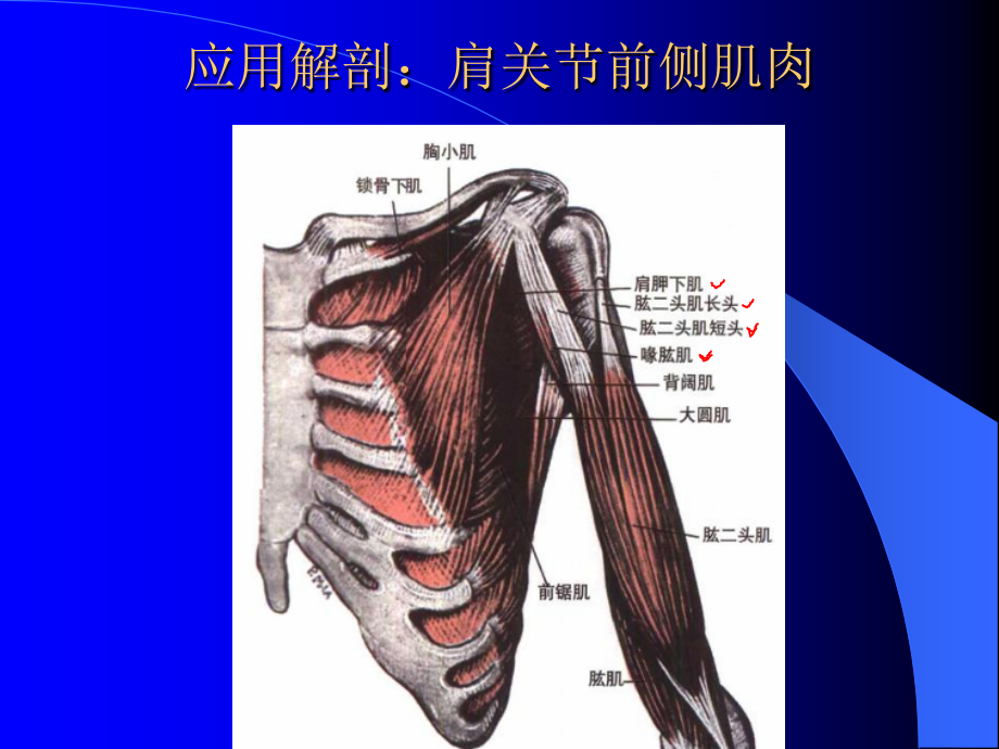 肩关节“C”形针刀松解术治疗肩周炎.ppt_第3页