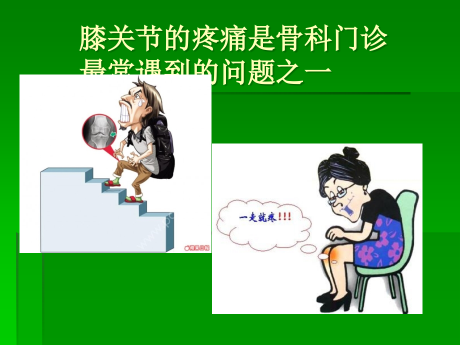 膝关节疼痛的诊断与治疗.ppt_第2页