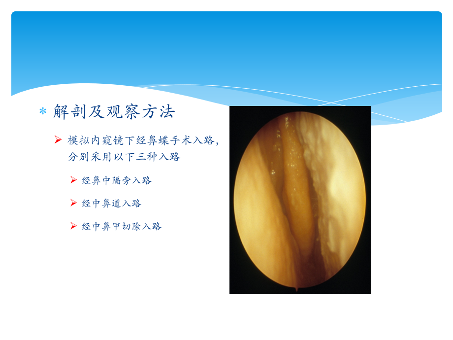 经单孔-鼻蝶入路切除鞍区病变的显微解剖与临床手术技巧.ppt_第3页