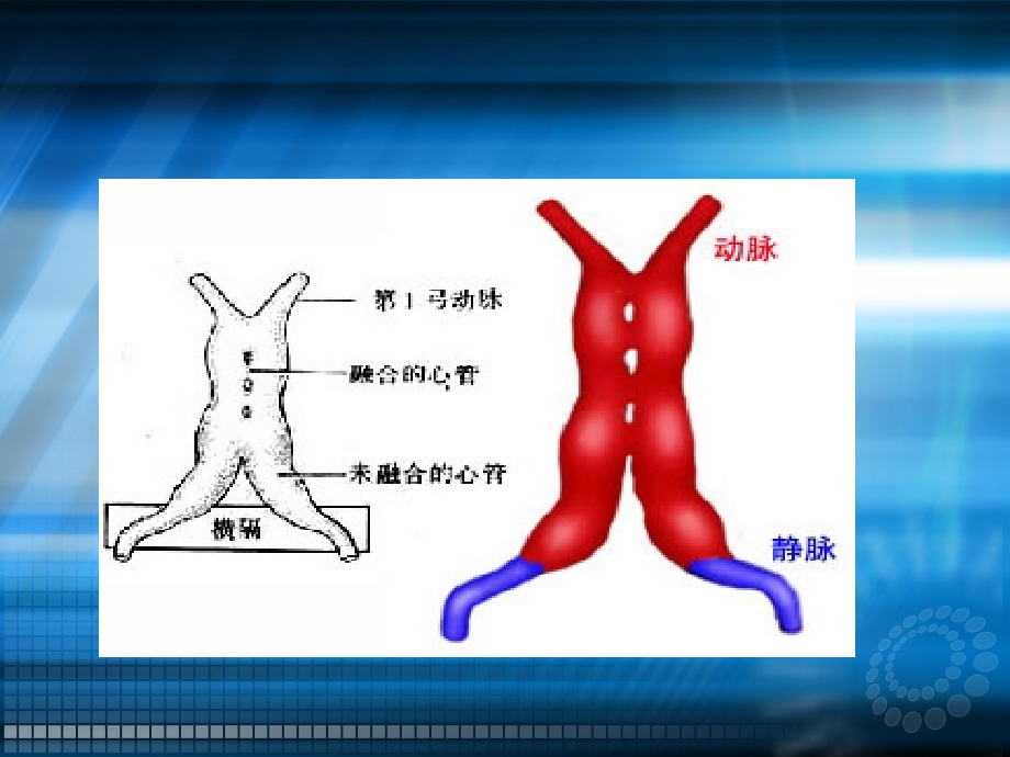 见习先天性心脏病.ppt_第3页