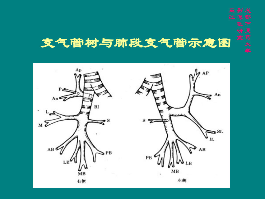 肺部CT解剖结构ppt课件.ppt_第3页