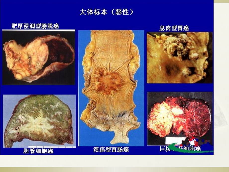 肿瘤学概论.ppt_第3页