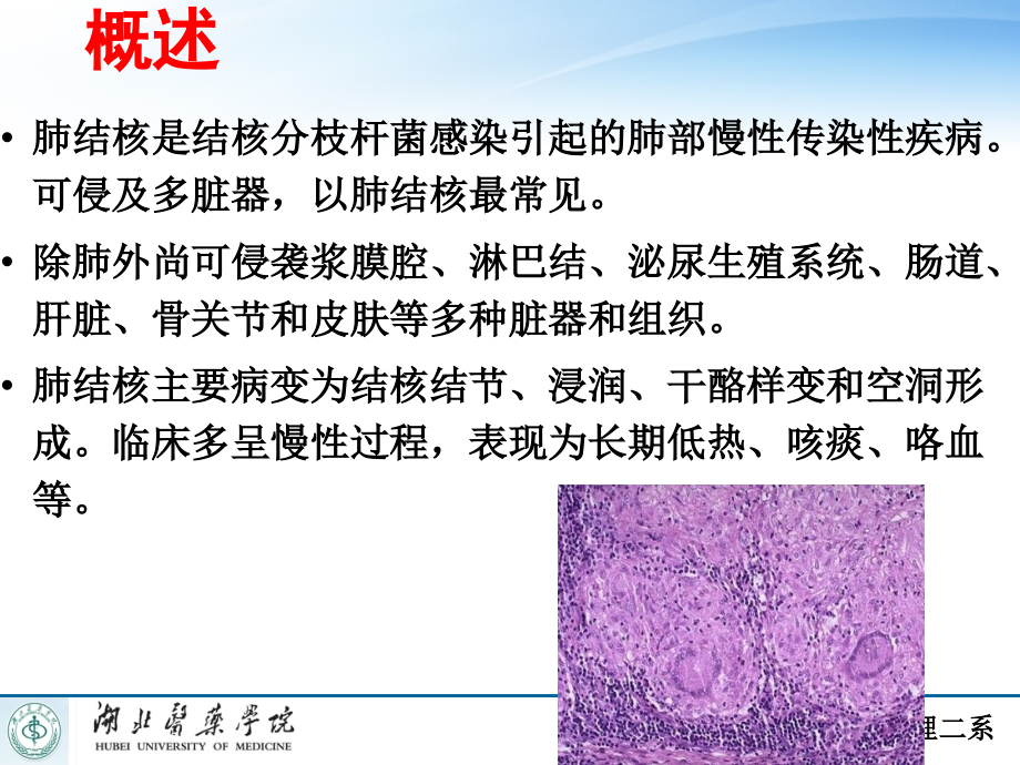 肺结核本科内科护理临床部分ppt课件.ppt_第2页