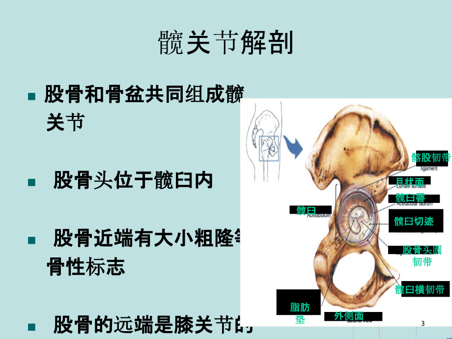 人工髋关节置换术的护理.ppt_第3页