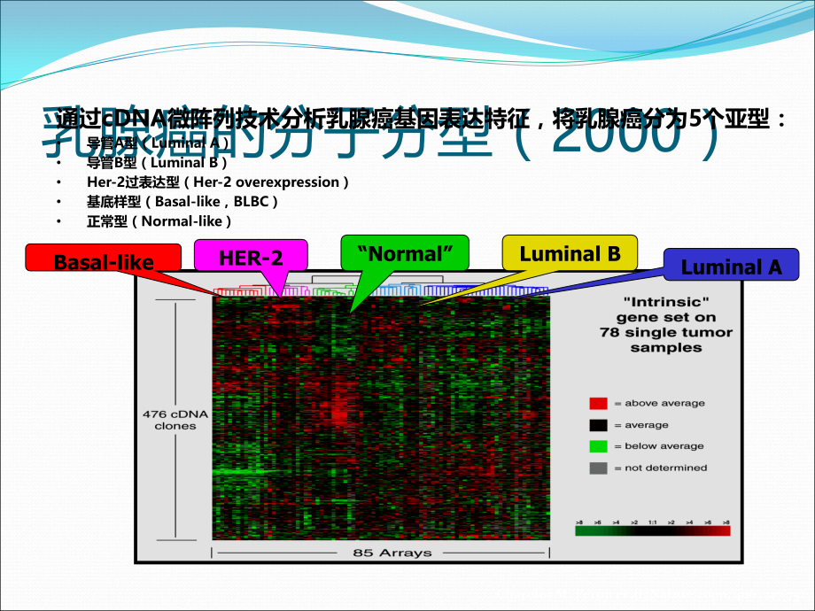 三阴性乳腺癌的分子分型.pptx_第2页