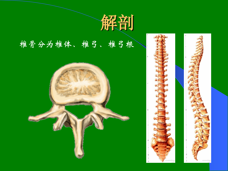 腰椎骨折患者的护理ppt课件.ppt_第2页