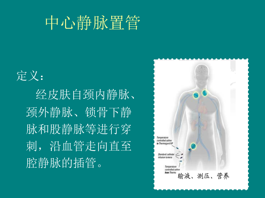 血液透析中心静脉导管的护理ppt课件.ppt_第3页