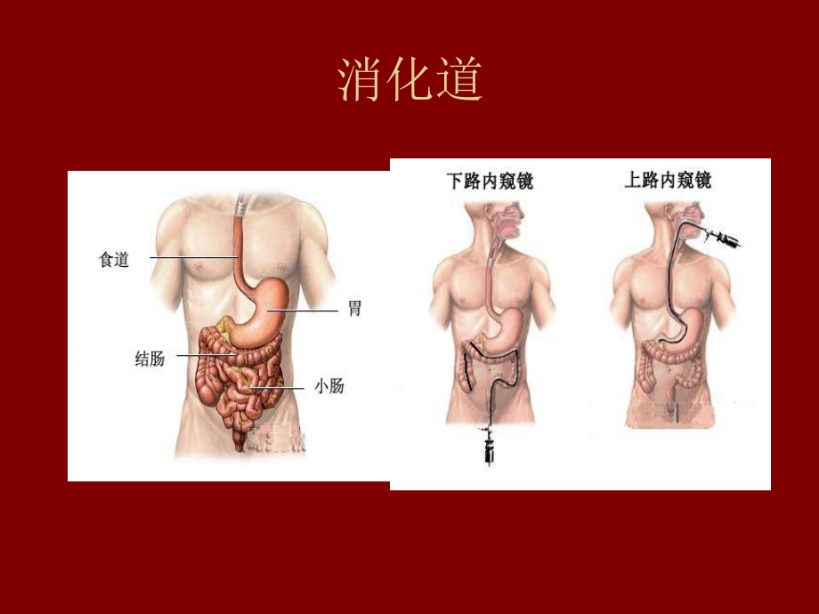 消化系统常见症状.ppt_第2页