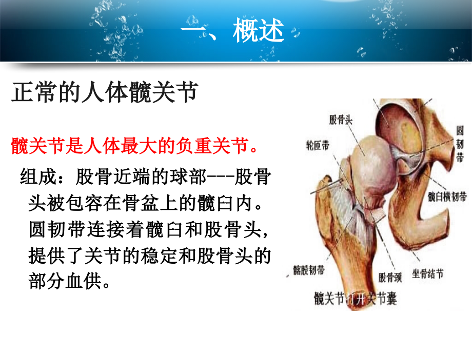 全髋关节置换术的教学查房.pptx_第3页