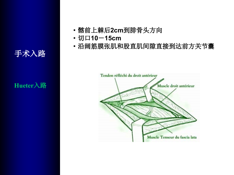 全髋关节置换手术入路.pptx_第3页