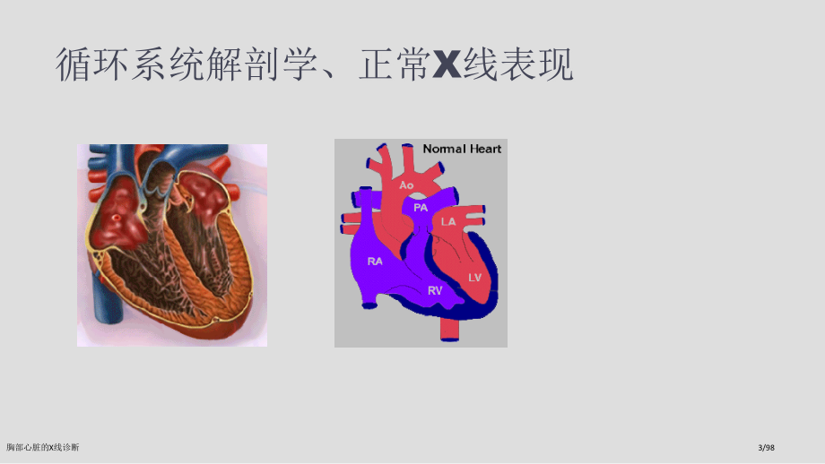 胸部心脏的X线诊断.pptx_第3页