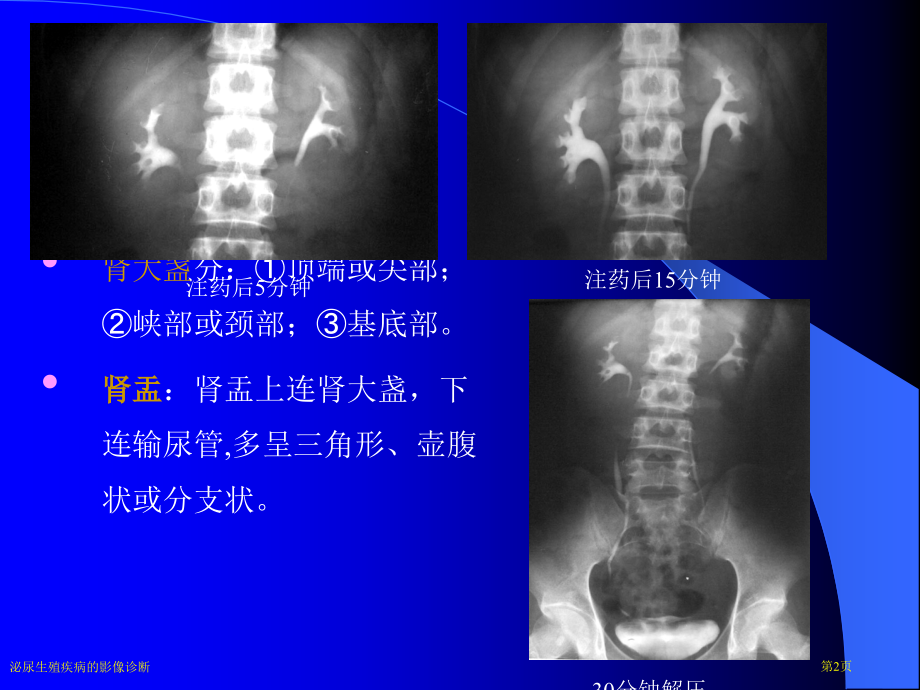 泌尿生殖疾病的影像诊断专家讲座.pptx_第2页