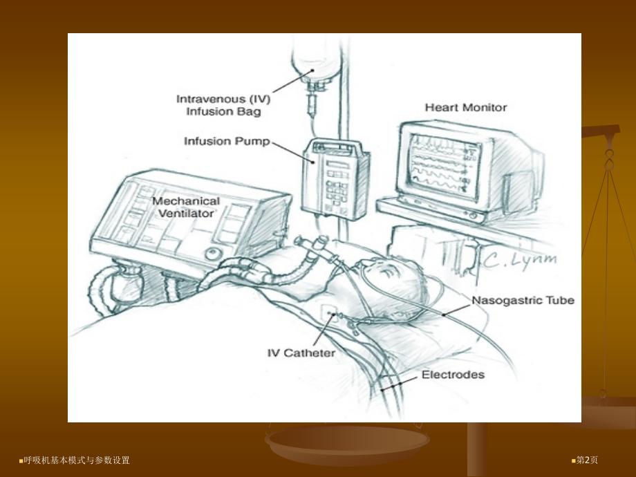 呼吸机基本模式与参数设置.pptx_第2页