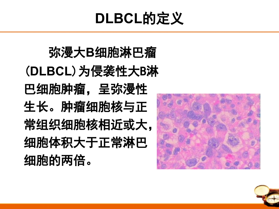 中国弥漫大B细胞淋巴瘤诊治指南.pptx_第2页