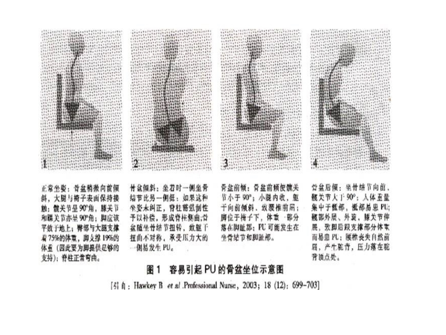 压疮护理进展.pptx_第2页