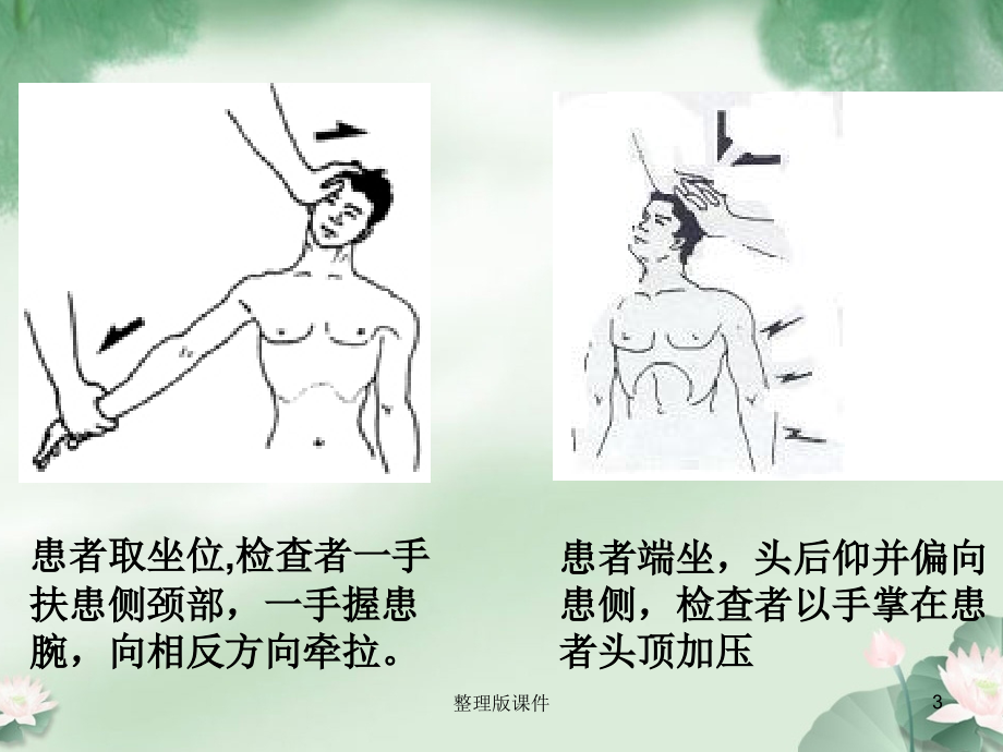 项痹病中医护理查房课件.ppt_第3页