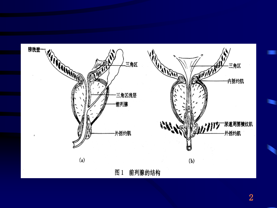 前列腺增生症的临床表现-诊断和治疗.ppt_第2页