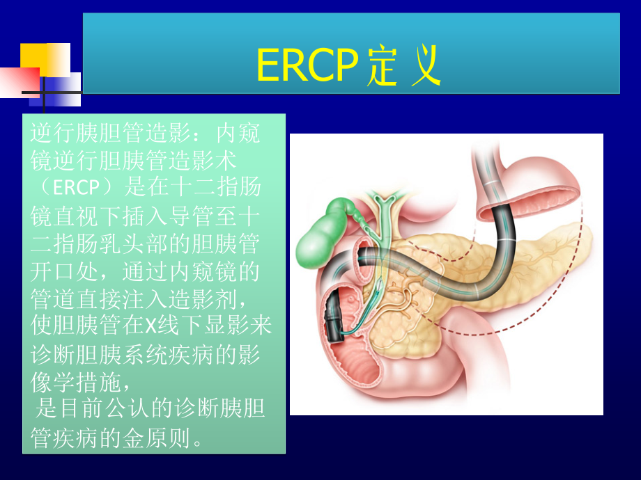 ERCP术前准备和术后护理.ppt_第2页