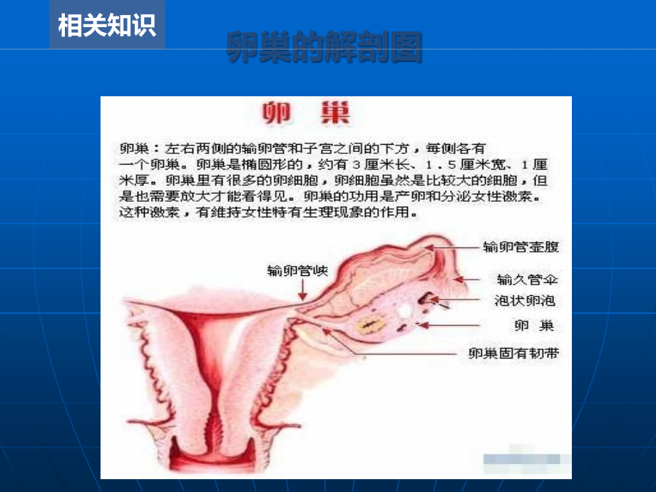 一例卵巢囊肿患者的护理查房.ppt_第3页