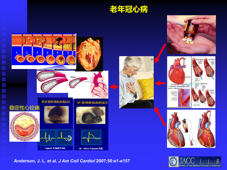 老冠心病患者心脏康复治疗的基本概念.ppt_第2页