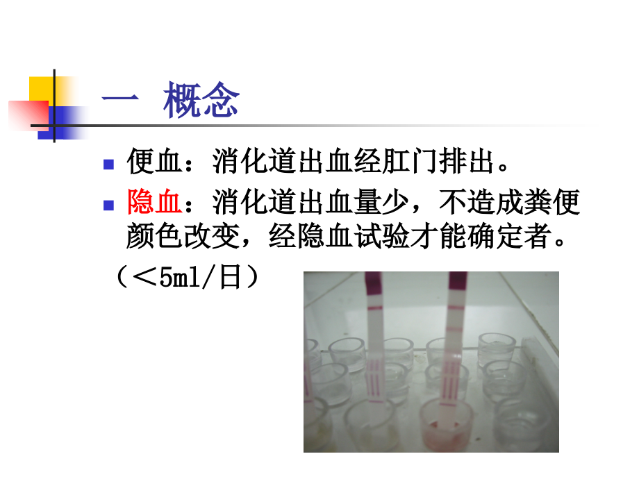 5.便血-诊断学讲课稿.ppt_第2页