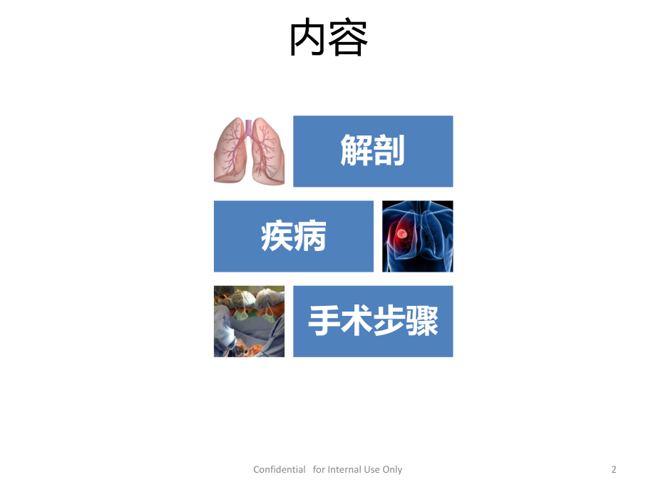 胸腔镜肺楔形切除术演示教学.pptx_第2页