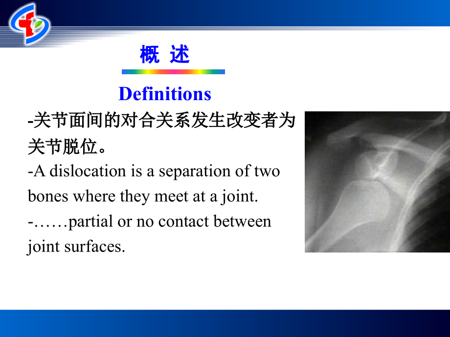 关节损伤和脱位学习资料.ppt_第3页