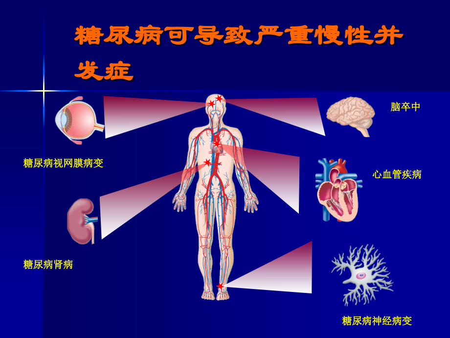 胰岛素的分类及应用教学提纲.ppt_第3页