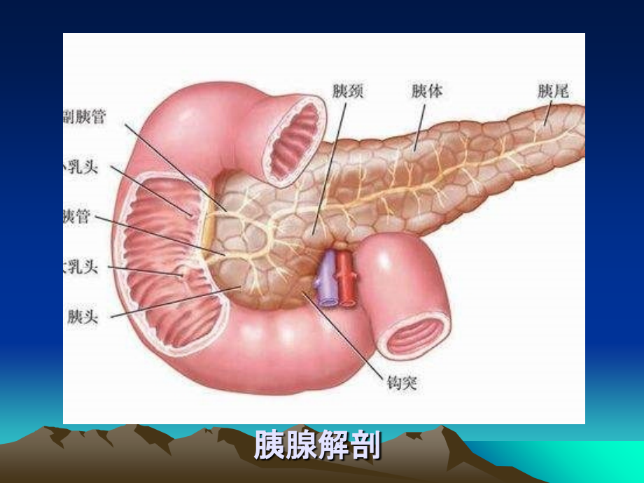 胰腺的超声诊断讲解学习.ppt_第3页