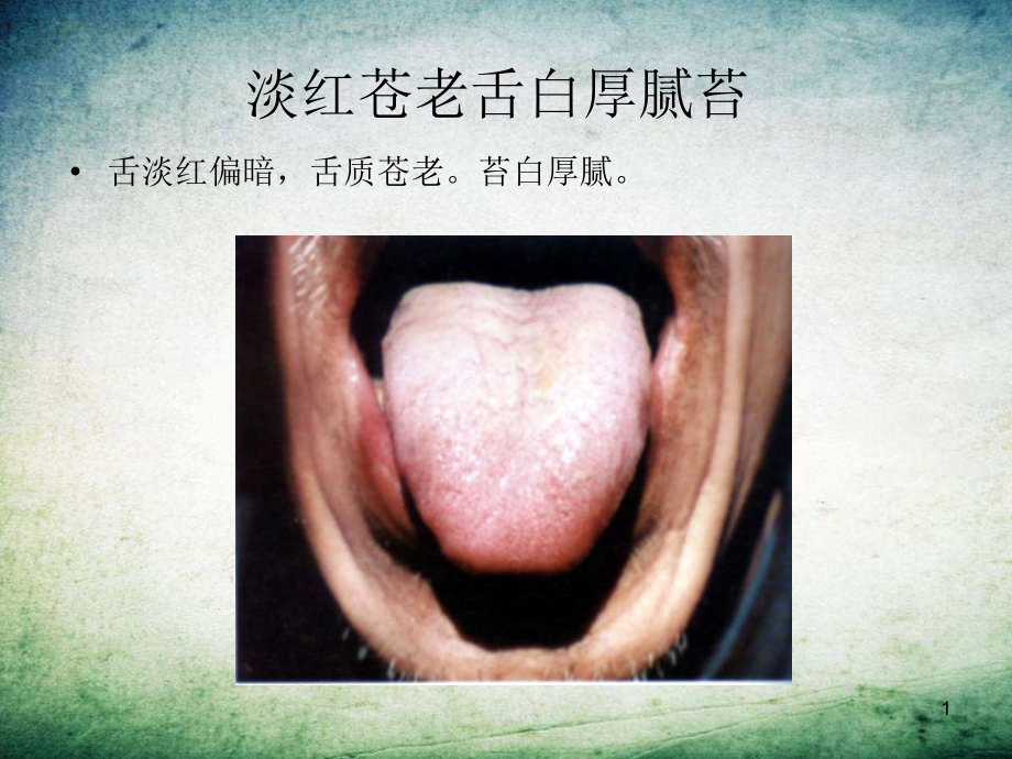 中医舌诊图谱-.ppt_第1页