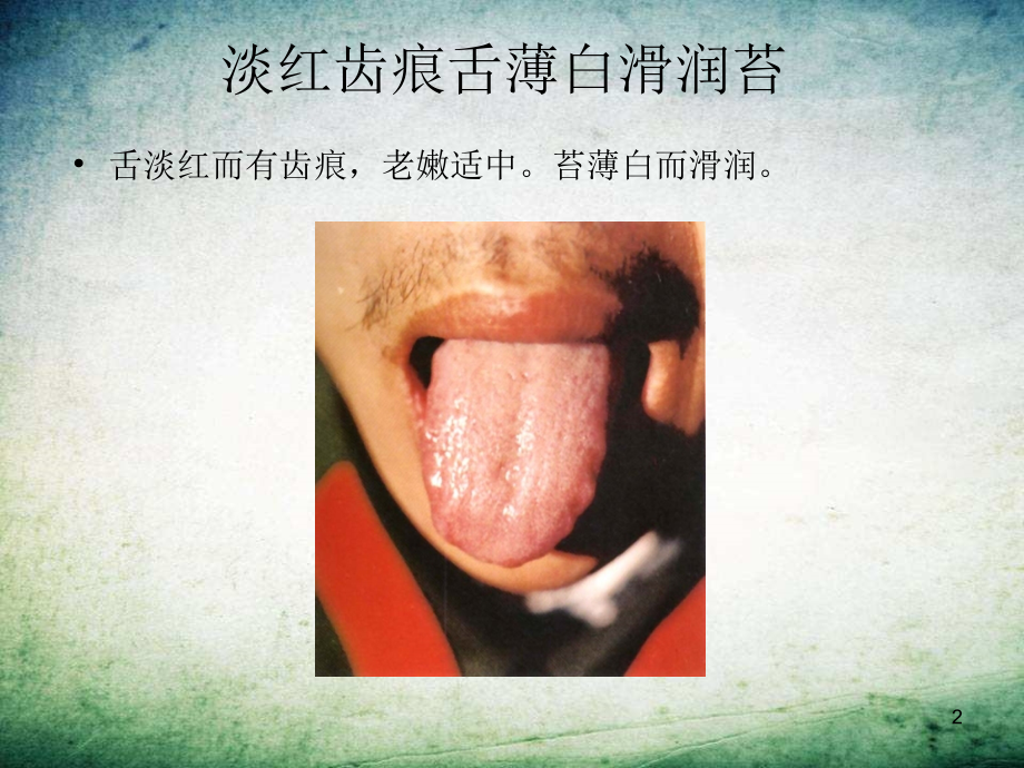 中医舌诊图谱-.ppt_第2页