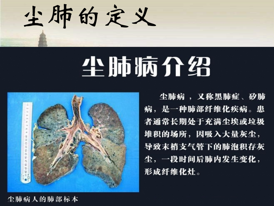 尘肺的职业病防护ppt.ppt_第2页