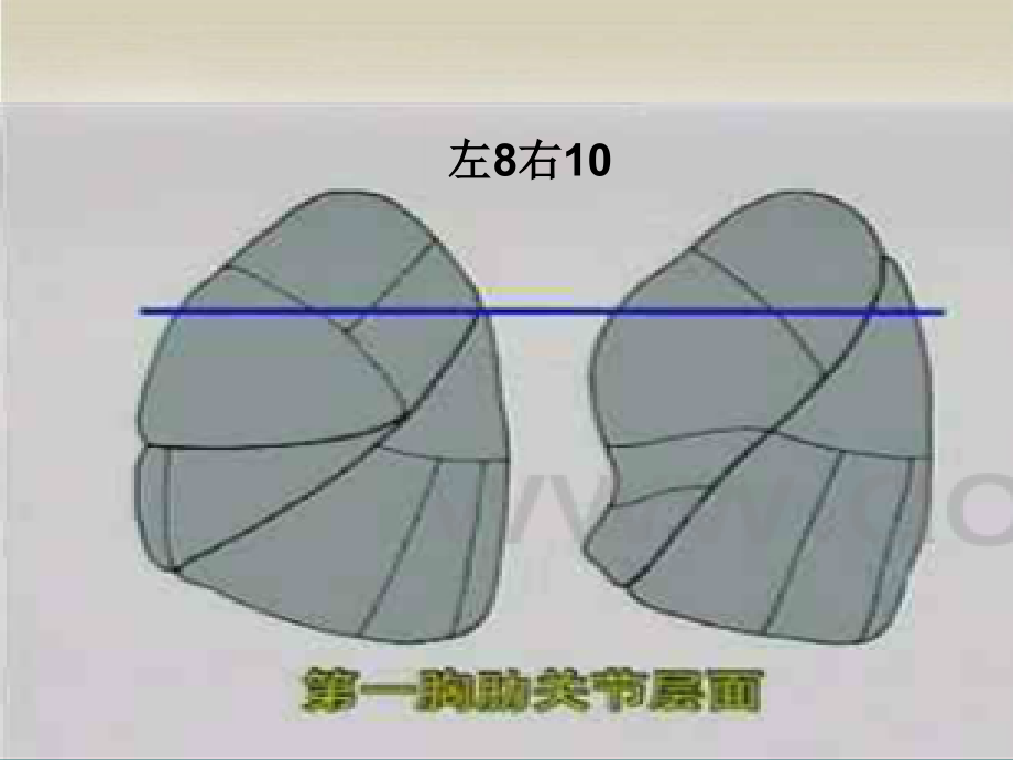 胸部CT读片指南-PPT.ppt_第2页