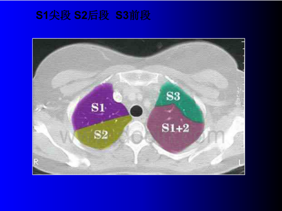 胸部CT读片指南-PPT.ppt_第3页