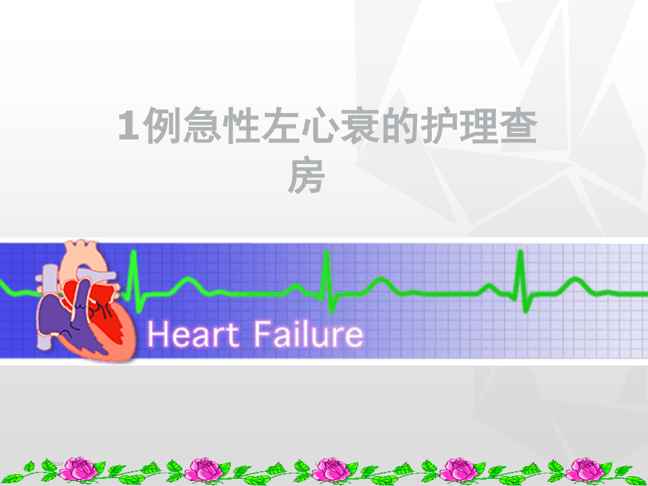 护理查房-.ppt_第1页