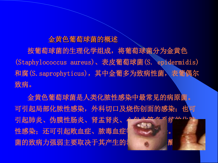 金黄色葡萄球菌知识培训.ppt_第3页