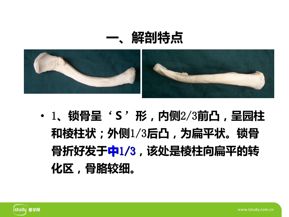 锁骨骨折-PPT.ppt_第2页