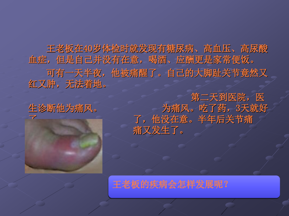 高尿酸血症和痛风健康教育.ppt_第2页