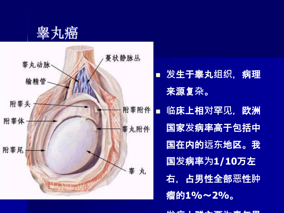 睾丸肿瘤诊断治疗指南ppt课件.ppt_第2页