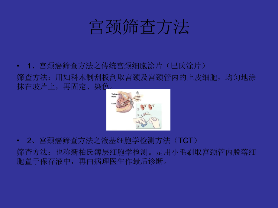 宫颈病毒筛查ppt课件.ppt_第2页