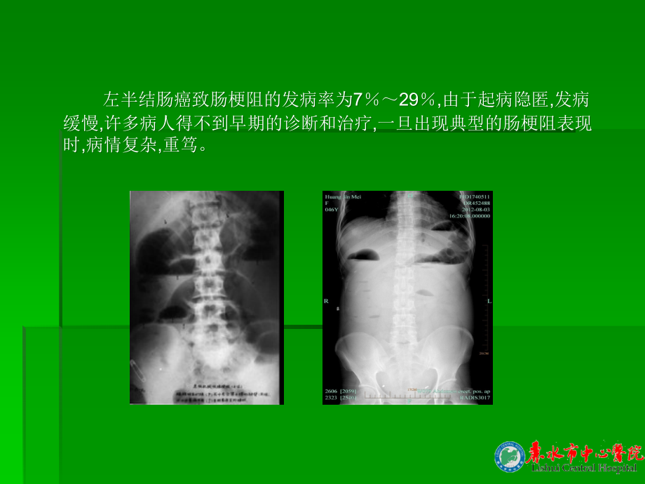 扩大右半结肠新.ppt_第3页