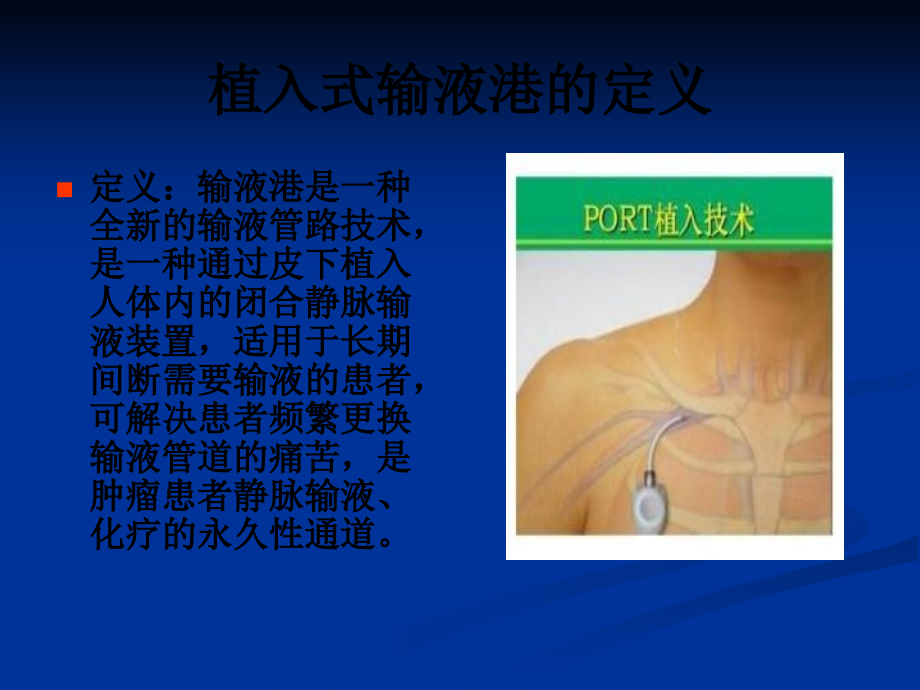 输液港护理小讲课.ppt_第3页