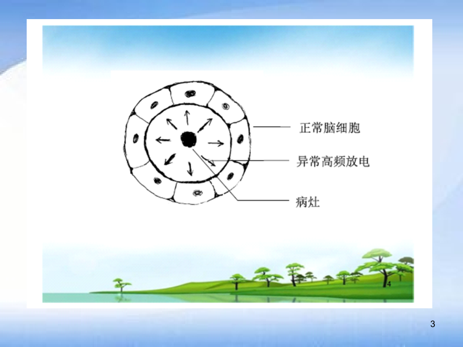 抗癫痫药物有哪些.ppt_第3页