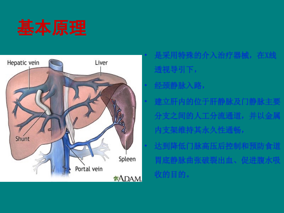 高尿酸血症与痛风的规范化诊治.ppt_第2页